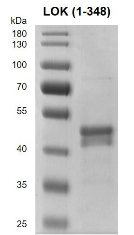 Recombinant STK10 / LOK (1-348) protein - MyBio Ireland - Active Motif