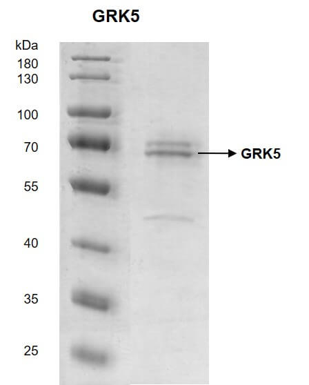 Recombinant GRK5 protein - MyBio Ireland - Active Motif