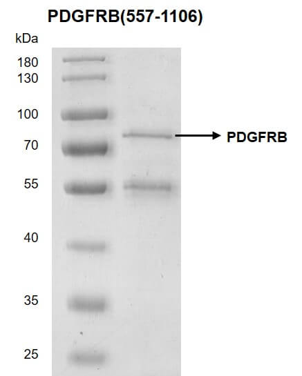 Recombinant PDGFRB (557-1106) protein - MyBio Ireland - Active Motif