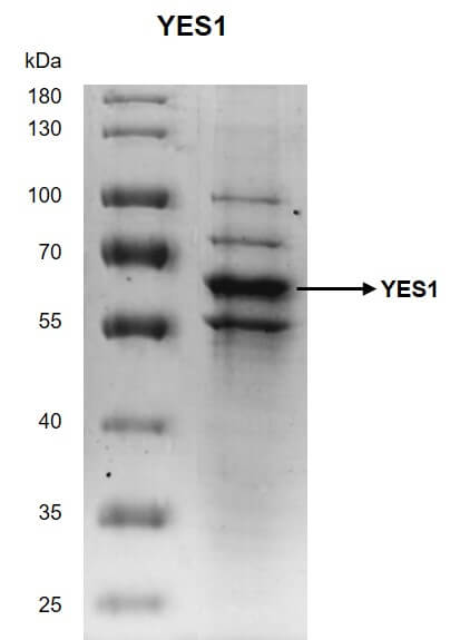 Recombinant YES1 protein - MyBio Ireland - Active Motif