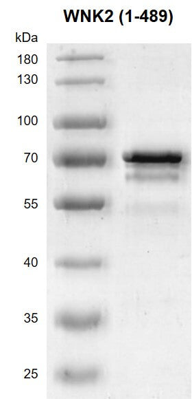 Recombinant WNK2 (1-489) protein - MyBio Ireland - Active Motif