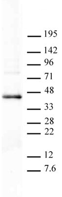 PRMT6 antibody (pAb) - MyBio Ireland - Active Motif