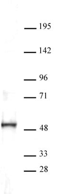ERR-α antibody (pAb) - MyBio Ireland - Active Motif