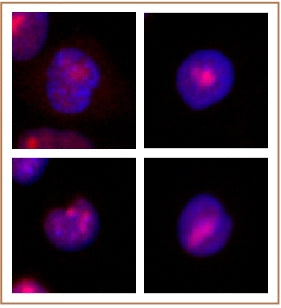 WRN antibody (mAb) (Clone 195C), sample - MyBio Ireland - Active Motif