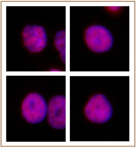HNF4A antibody (pAb) - MyBio Ireland - Active Motif