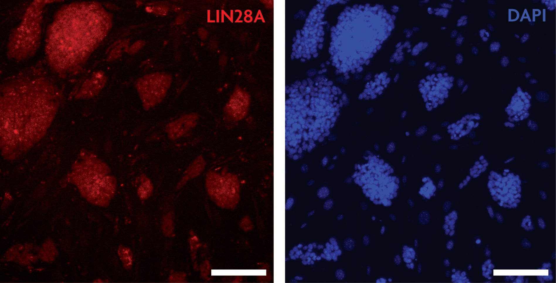 LIN28A antibody (pAb) - MyBio Ireland - Active Motif