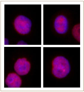 JMJD2B / KDM4B antibody (pAb) - MyBio Ireland - Active Motif