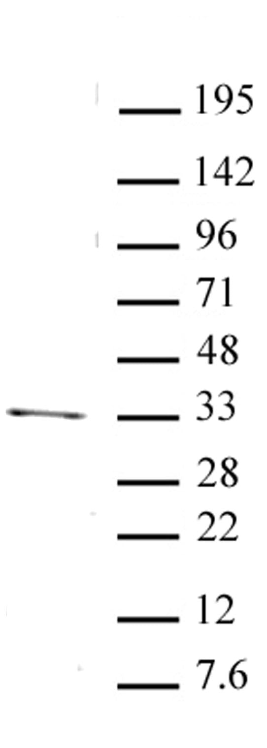 PITX2 antibody (pAb) - MyBio Ireland - Active Motif