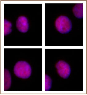 Uhrf1 antibody (mAb) (Clone 1RC-1C10) - MyBio Ireland - Active Motif
