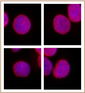 SMARCC1 / BAF155 antibody (pAb), sample - MyBio Ireland - Active Motif