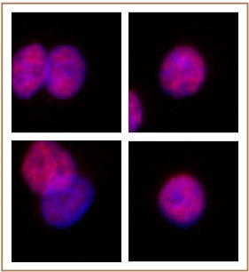 SMARCC2 / BAF170 antibody (pAb) - MyBio Ireland - Active Motif