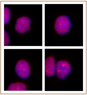 PRMT2 antibody (pAb), sample - MyBio Ireland - Active Motif