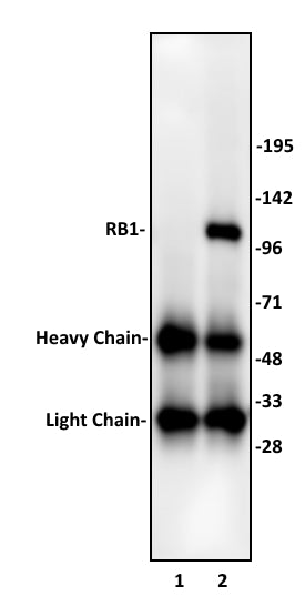 RB1 antibody (pAb) - MyBio Ireland - Active Motif