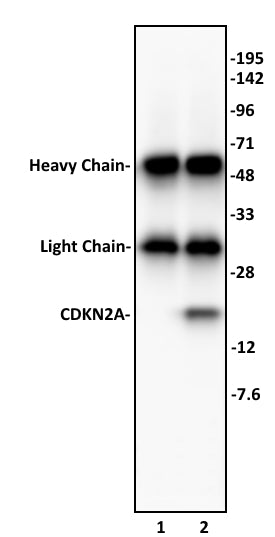 CDKN2A antibody (pAb), sample - MyBio Ireland - Active Motif