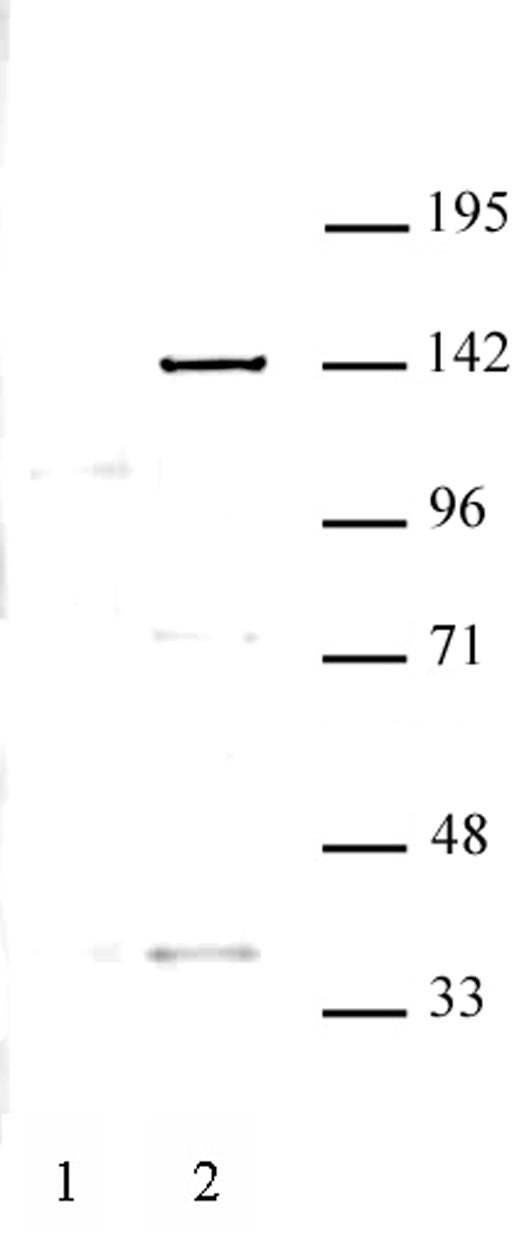 KDM4C antibody (pAb) - MyBio Ireland - Active Motif