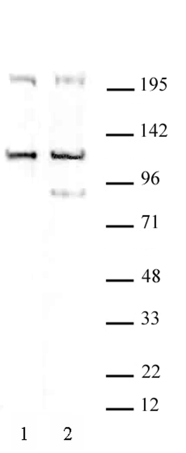 TRIM37 antibody (pAb), sample - MyBio Ireland - Active Motif