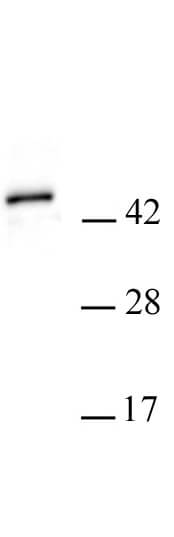 PHF6 antibody (pAb) - MyBio Ireland - Active Motif