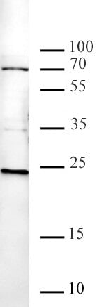 Histone H2AK119ub antibody (pAb) - MyBio Ireland - Active Motif
