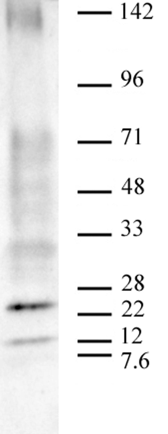 AbFlex® Ubiquitin antibody (rAb), sample - MyBio Ireland - Active Motif