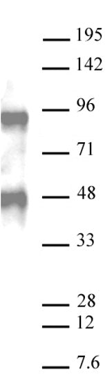 AbFlex® Bcl6 antibody (rAb) - MyBio Ireland - Active Motif
