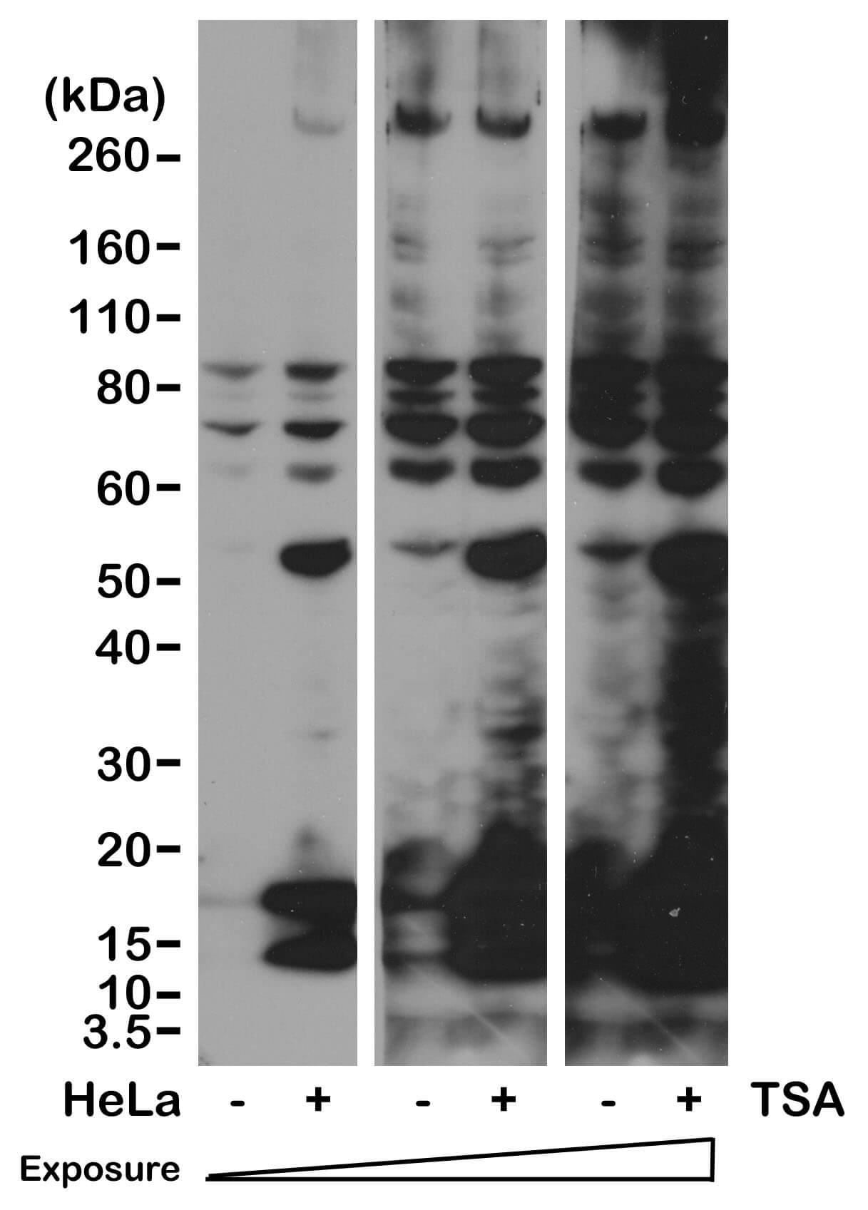 Acetyl-Lysine antibody (rAb) - MyBio Ireland - Active Motif