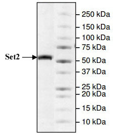 Recombinant SETD2 (1418-1714) protein - MyBio Ireland - Active Motif