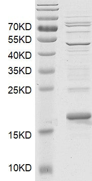 Recombinant BRD3 (306-416) protein - MyBio Ireland - Active Motif