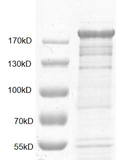 Recombinant PRDM10 protein - MyBio Ireland - Active Motif