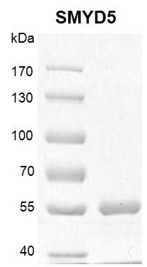 Recombinant SMYD5 protein - MyBio Ireland - Active Motif