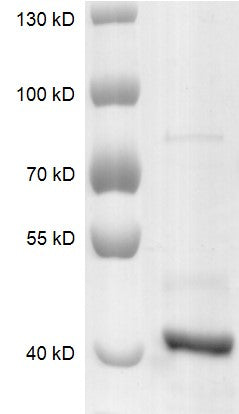 Recombinant SETD8 protein - MyBio Ireland - Active Motif