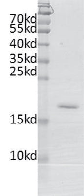 Recombinant BRDT (21-137) protein - MyBio Ireland - Active Motif