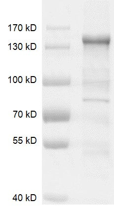 Recombinant HDAC6 (597-728, deleted mutant) protein - MyBio Ireland - Active Motif