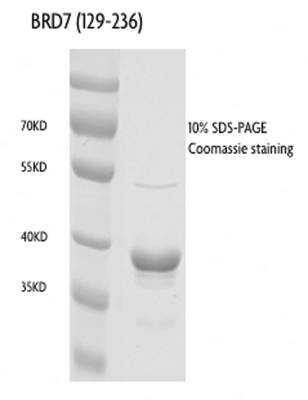 Recombinant BRD7 (129-236) protein, GST-Tag - MyBio Ireland - Active Motif