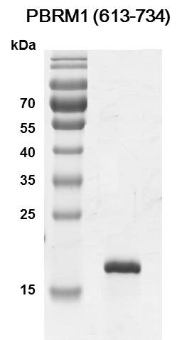 Recombinant PBRM1 (613-734) protein - MyBio Ireland - Active Motif