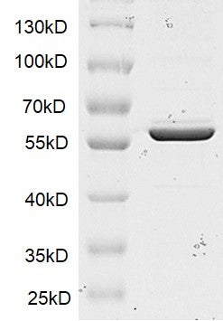 Recombinant SMYD1 protein - MyBio Ireland - Active Motif