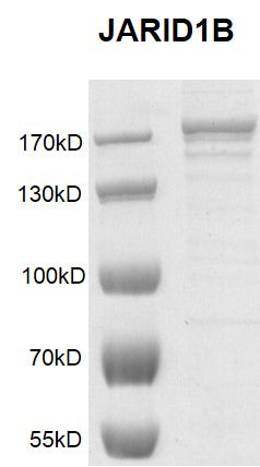 Recombinant JARID1B / KDM5B protein - MyBio Ireland - Active Motif