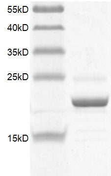 Recombinant BRD1 (556-688) protein - MyBio Ireland - Active Motif