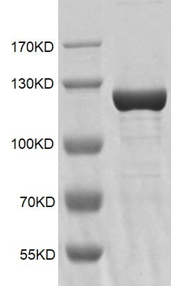 Recombinant KDM1B / LSD2 protein - MyBio Ireland - Active Motif