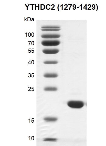 Recombinant YTHDC2 (1279-1429) protein - MyBio Ireland - Active Motif