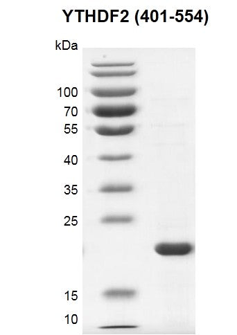 Recombinant YTHDF2 (401-554) protein - MyBio Ireland - Active Motif