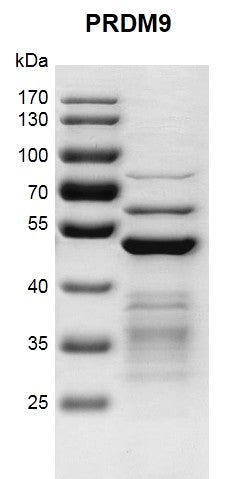 Recombinant PRDM9 (191-415) protein - MyBio Ireland - Active Motif