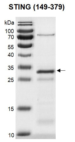 Recombinant TMEM173 (STING) (149-379) protein - MyBio Ireland - Active Motif