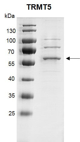 Recombinant TRMT5 protein - MyBio Ireland - Active Motif