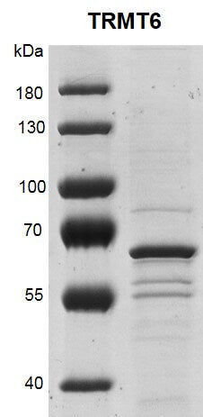 Recombinant TRMT6 protein - MyBio Ireland - Active Motif