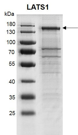 Recombinant LATS1 protein - MyBio Ireland - Active Motif