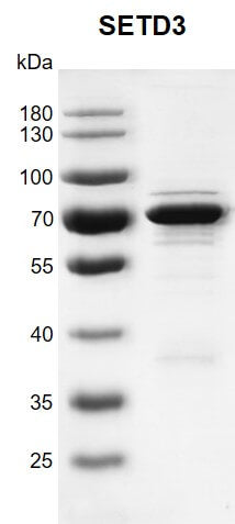 Recombinant SETD3 protein - MyBio Ireland - Active Motif