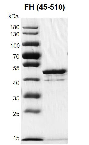 Recombinant Fumarase / FH (45-510) protein - MyBio Ireland - Active Motif