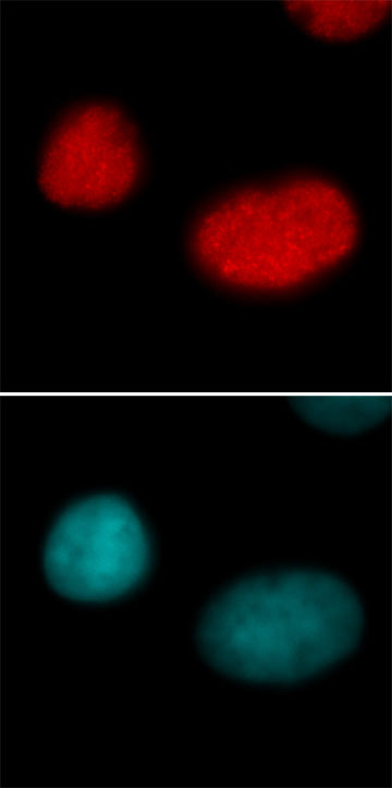 Histone H3K18ac antibody (pAb) - MyBio Ireland - Active Motif
