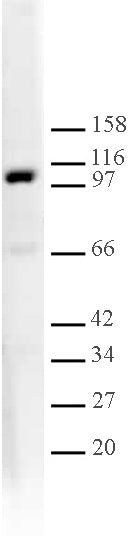 L3MBTL1 antibody (pAb), sample - MyBio Ireland - Active Motif