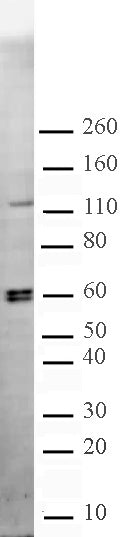 CARM1 antibody (pAb), sample - MyBio Ireland - Active Motif